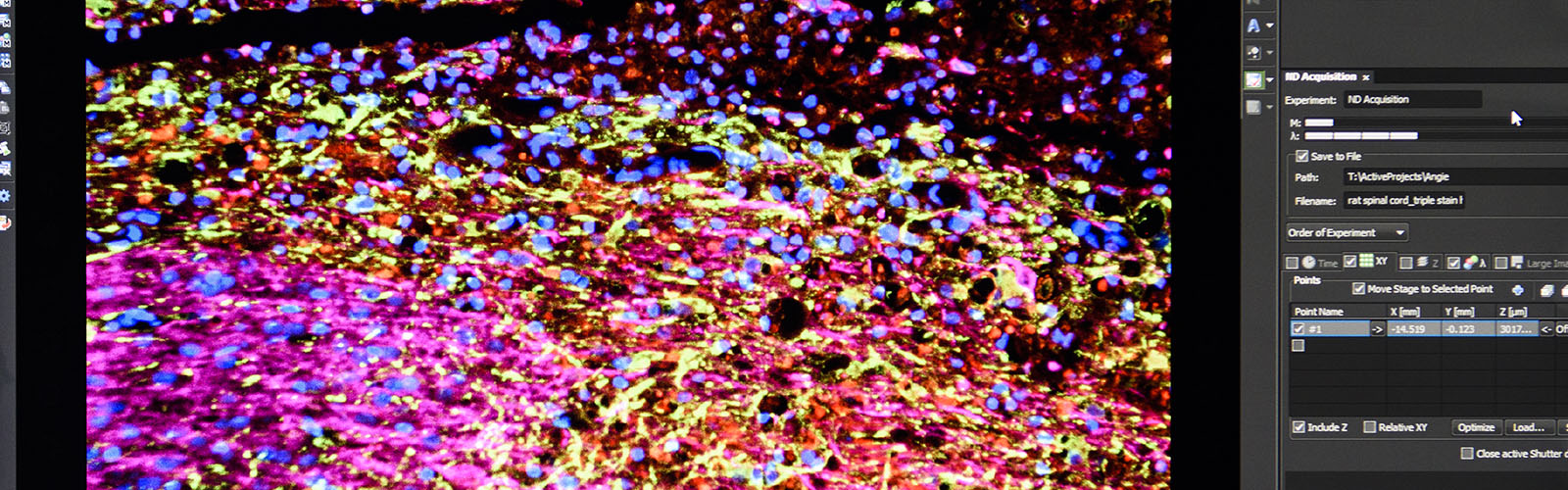 A computer monitor displaying an image of human stem cells that are counted using an image analysis program.